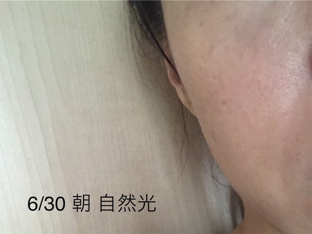 f:id:koshikakeol:20190702184311j:image f:id:koshikakeol:20190702184311j:image