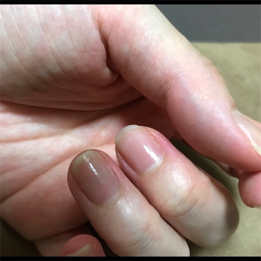 f:id:koshikakeol:20190715104712j:image