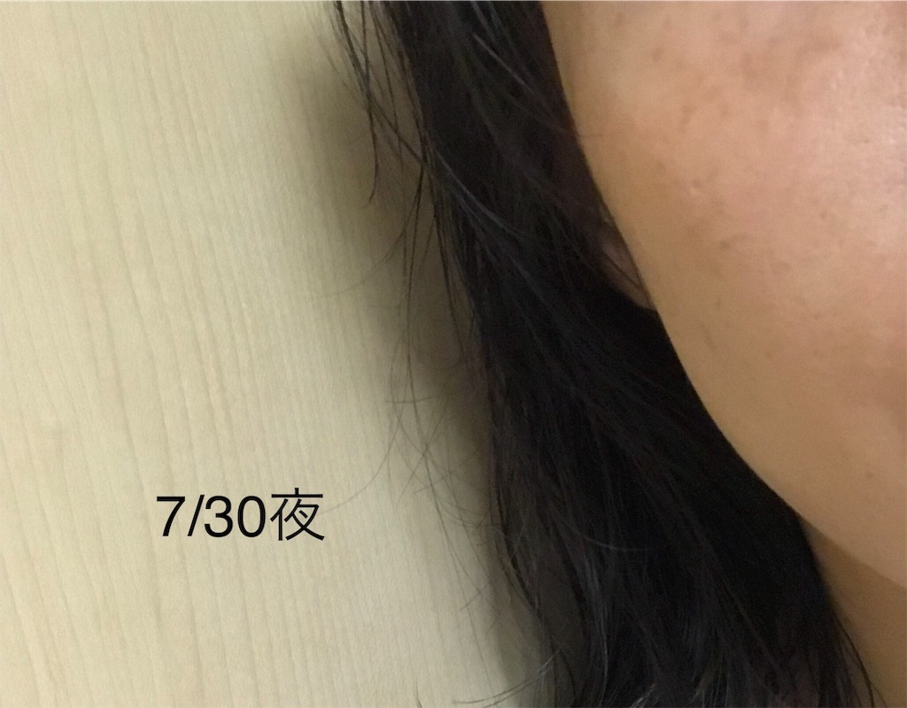 f:id:koshikakeol:20190730213727j:image f:id:koshikakeol:20190730213727j:image