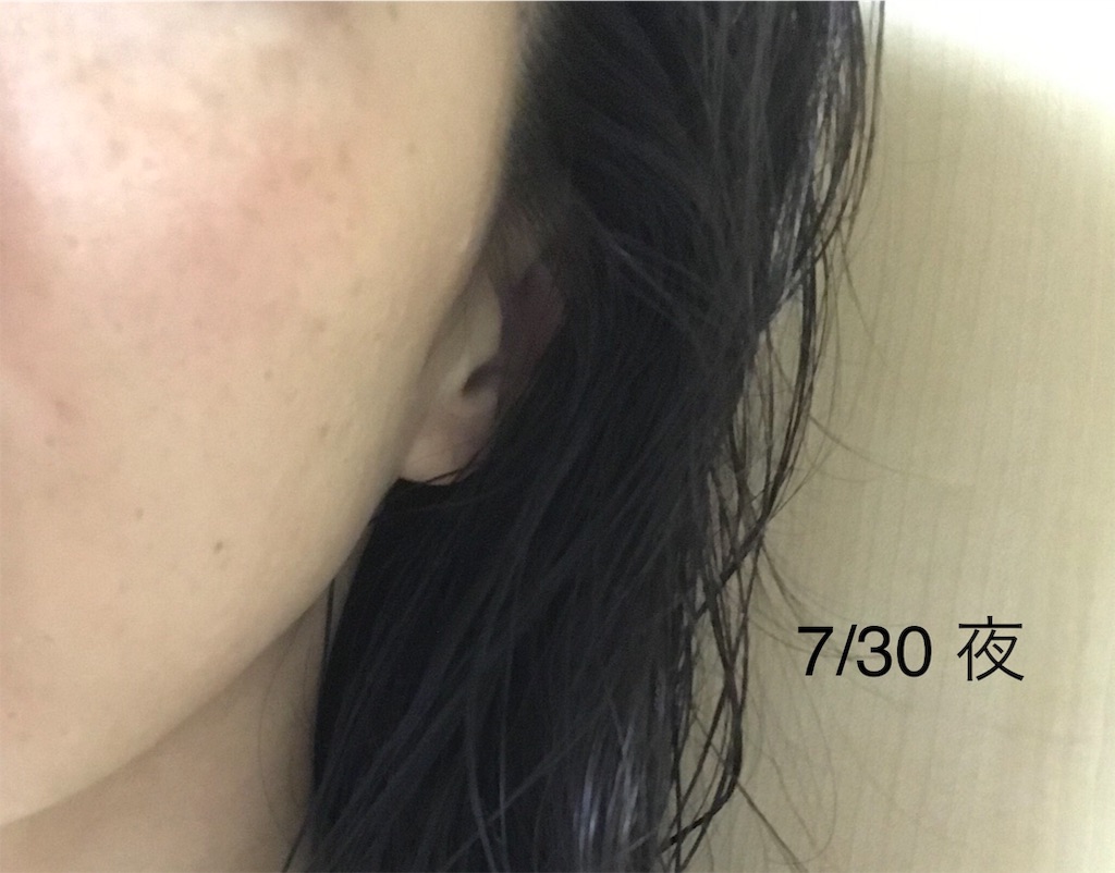 f:id:koshikakeol:20190730213742j:image f:id:koshikakeol:20190730213742j:image