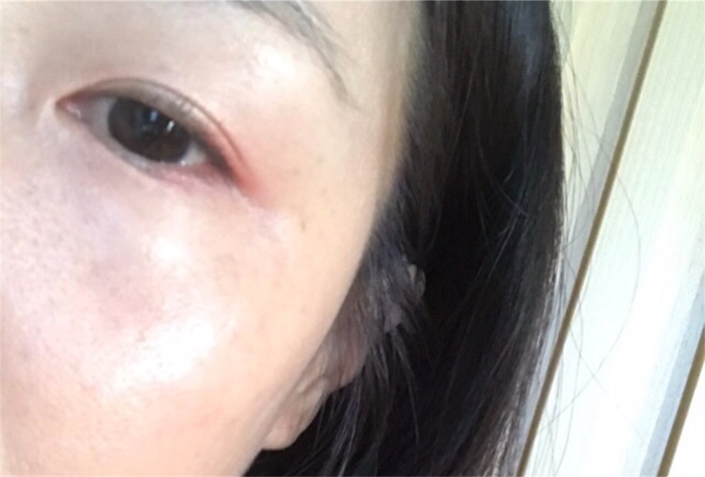 f:id:koshikakeol:20190807073815j:plain f:id:koshikakeol:20190807073815j:plain