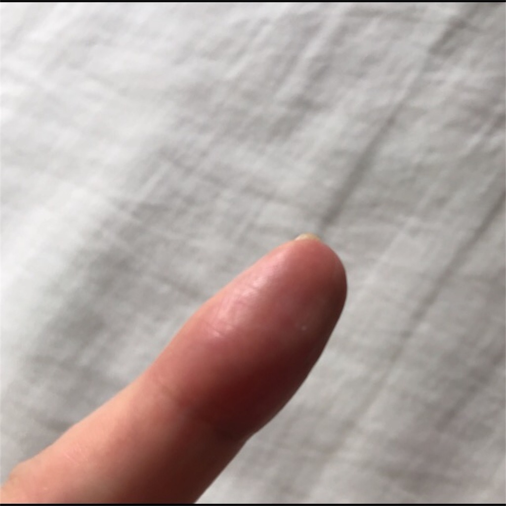 f:id:koshikakeol:20190915135235j:plain f:id:koshikakeol:20190915135235j:plain