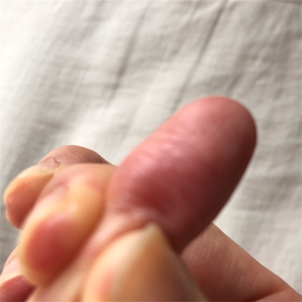 f:id:koshikakeol:20190915135238j:plain f:id:koshikakeol:20190915135238j:plain