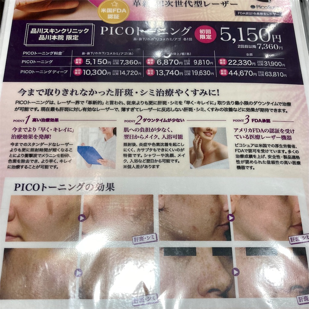 f:id:koshikakeol:20210711185359j:image f:id:koshikakeol:20210711185359j:image
