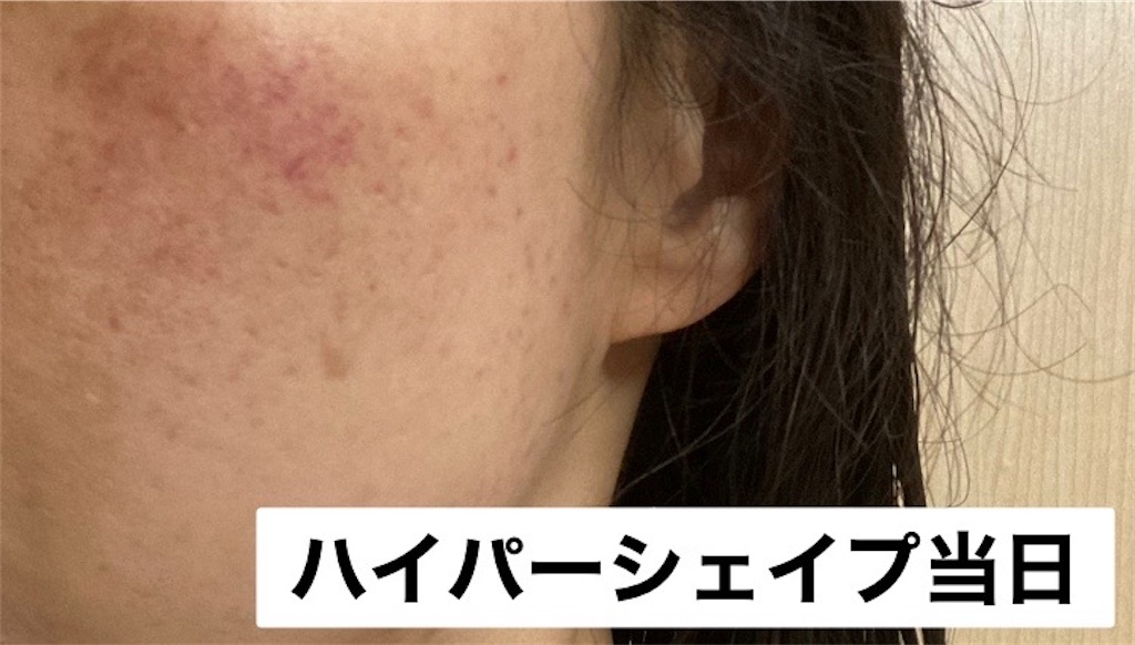 f:id:koshikakeol:20221211181510j:image f:id:koshikakeol:20221211181510j:image