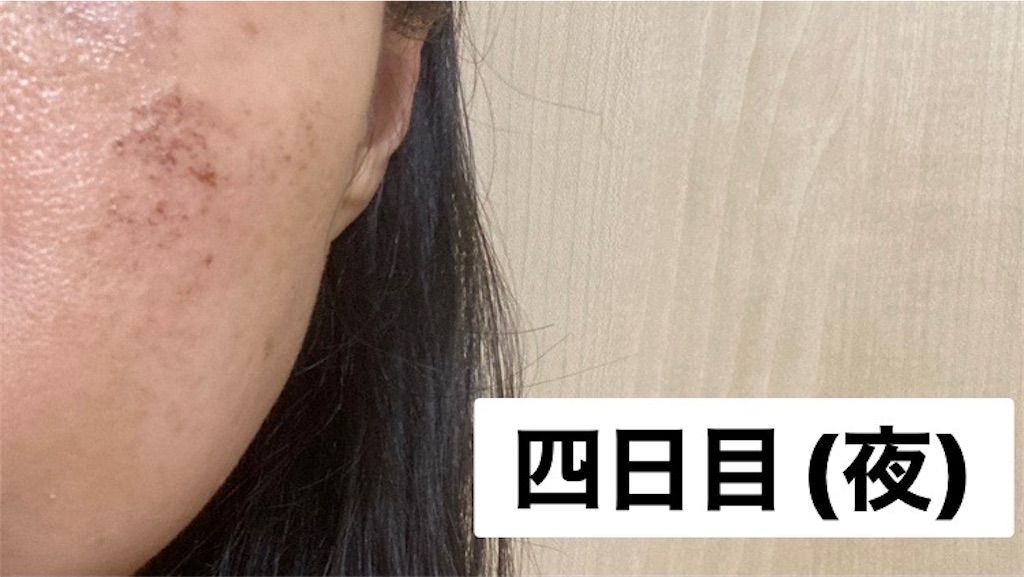 f:id:koshikakeol:20230119215939j:image