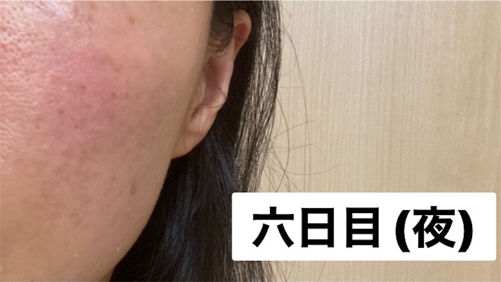 f:id:koshikakeol:20230121230435j:image