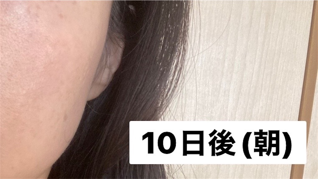 f:id:koshikakeol:20230125074719j:image