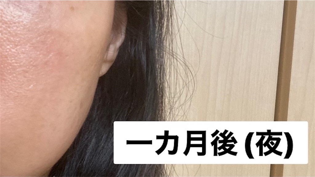 f:id:koshikakeol:20230214205630j:image