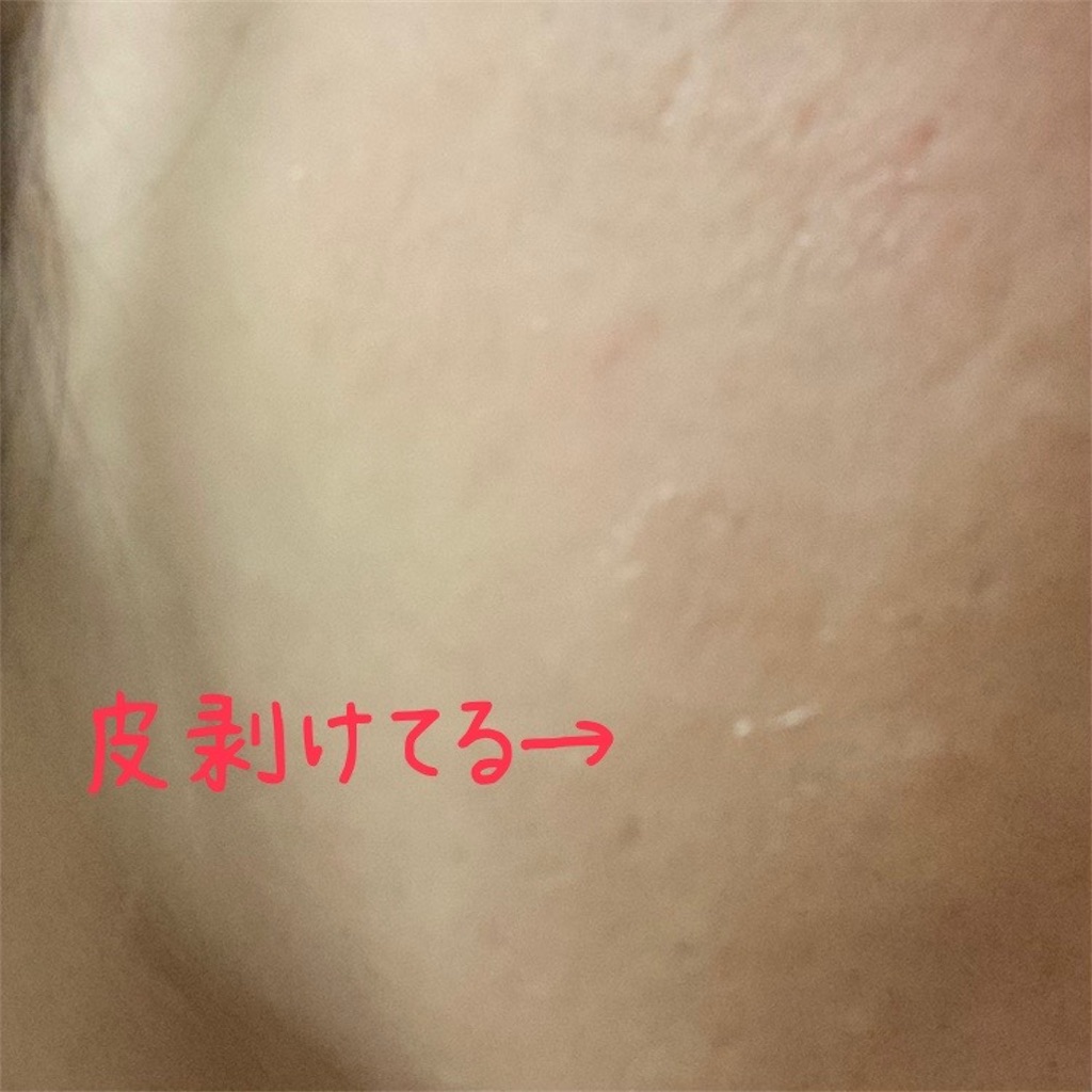 f:id:koshikakeol:20230608091238j:image
