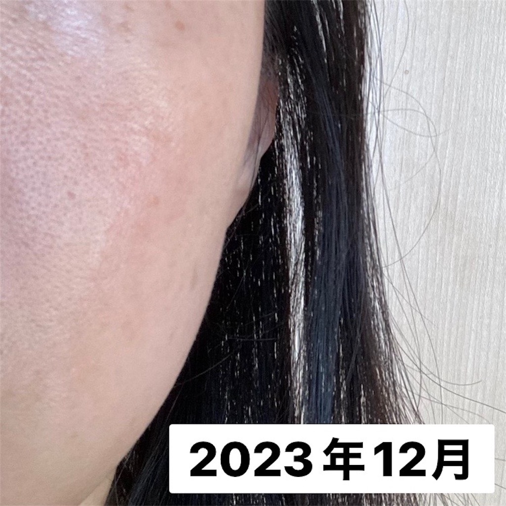 f:id:koshikakeol:20231215155847j:image f:id:koshikakeol:20231215155847j:image