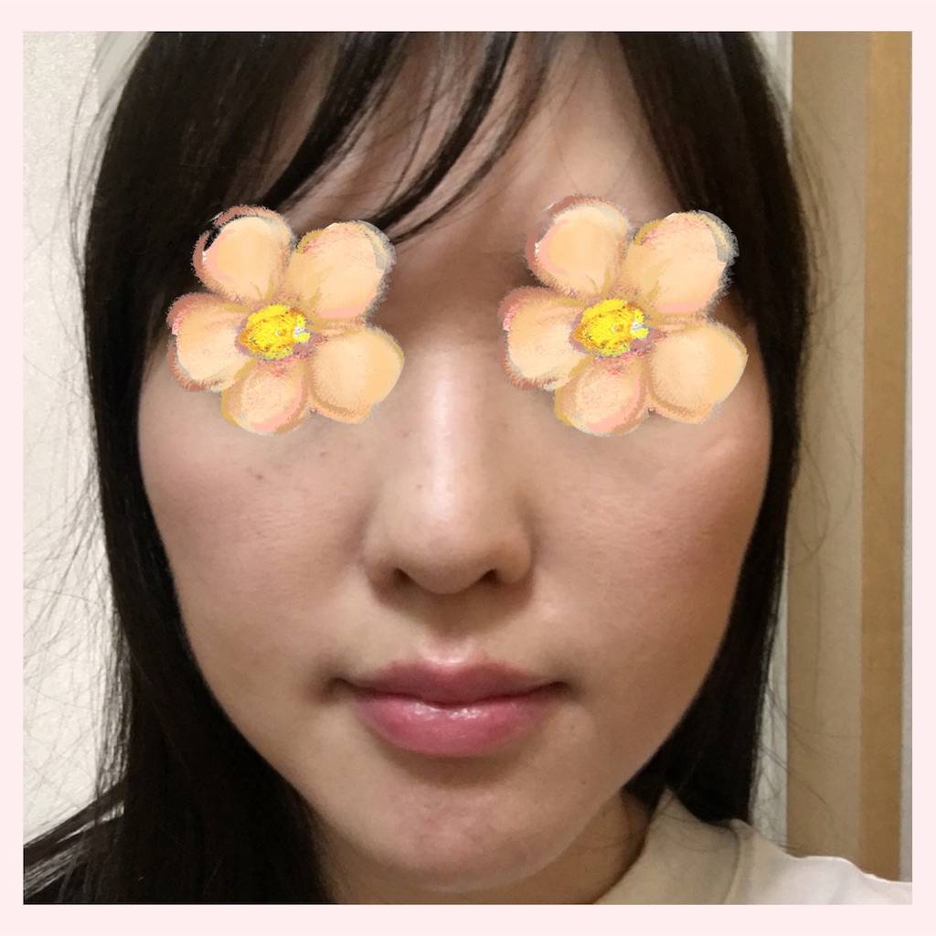 f:id:kosodatemama3:20190720173327j:image