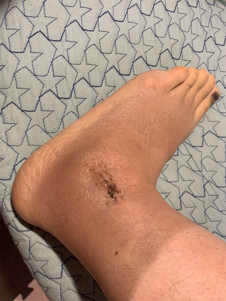 f:id:kossetsu_mama:20211227234532j:image f:id:kossetsu_mama:20211227234532j:image