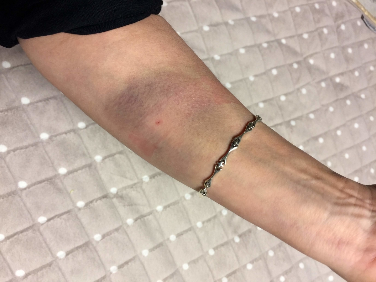 f:id:koteao:20191028090347j:plain