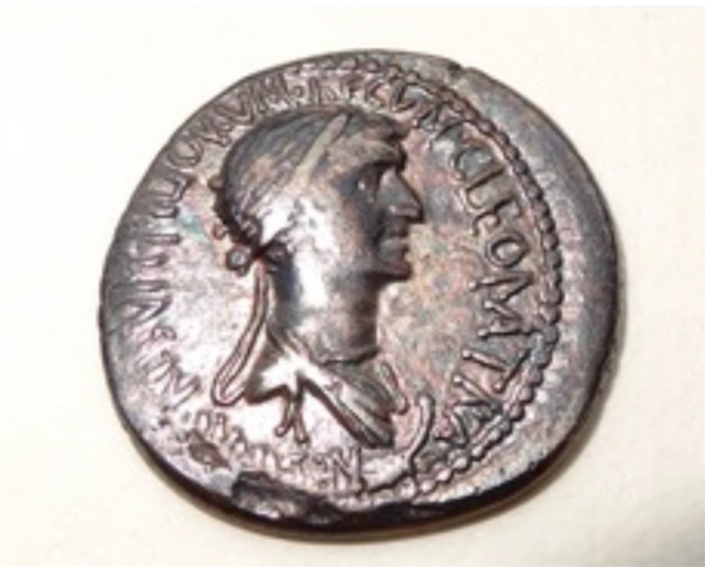 難病実体験 バセドウ病歴15年 初期症状の見分け方 セルフチェック付 完全 𝕂𝕠𝕥𝕖ℂ𝕙𝕒 目線