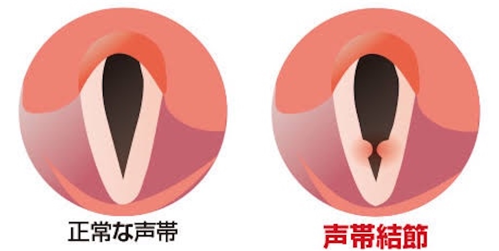 f:id:kotocham:20200917213742j:image f:id:kotocham:20200917213742j:image