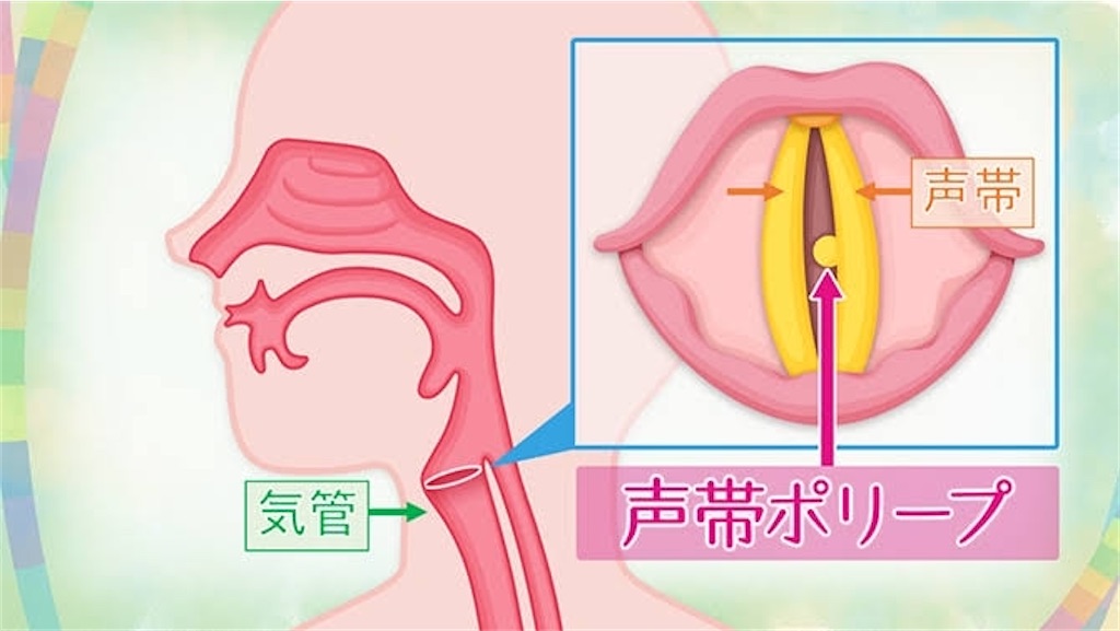f:id:kotocham:20200917213752j:image f:id:kotocham:20200917213752j:image