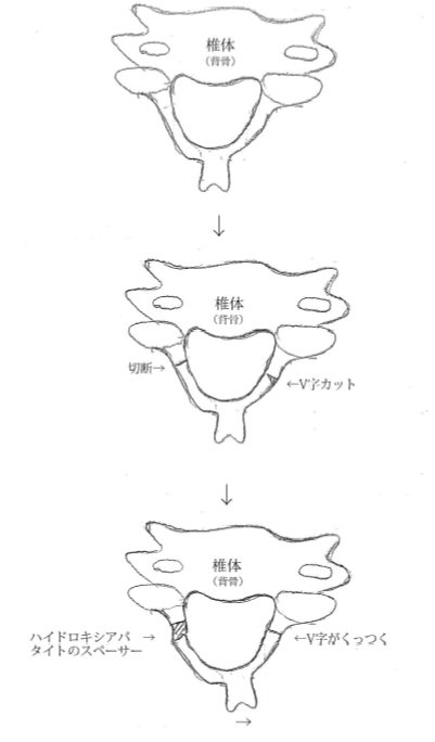 f:id:koufuku-kyouden:20200520115112p:plain