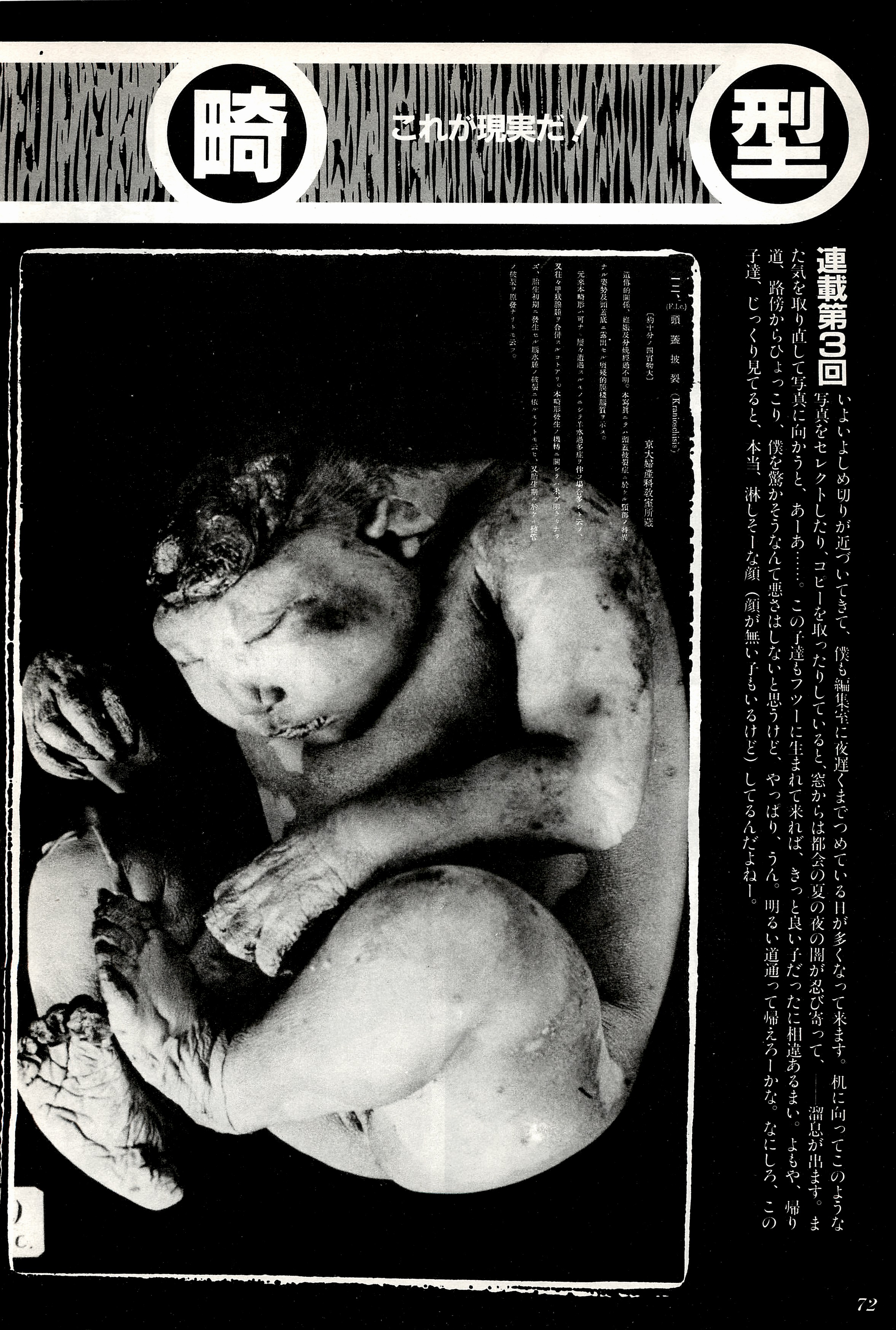 f:id:kougasetumei:20180507192713j:image