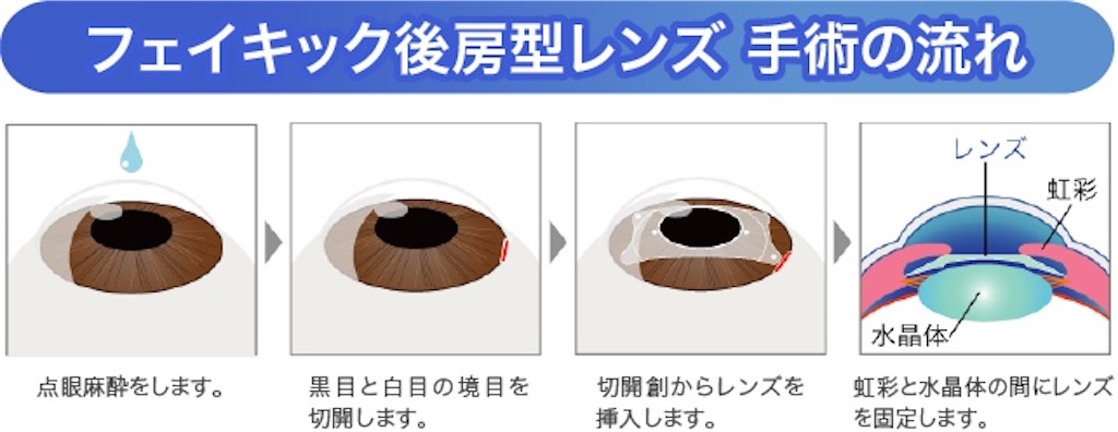 f:id:kouheizero:20210823071633j:image