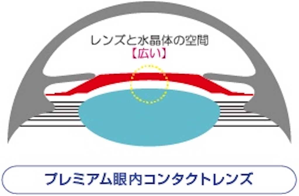 f:id:kouheizero:20210823072447j:image
