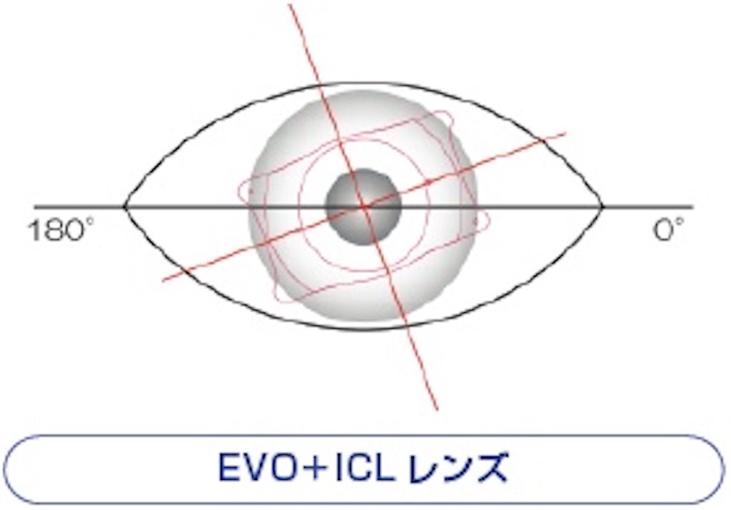 f:id:kouheizero:20210823072604j:image