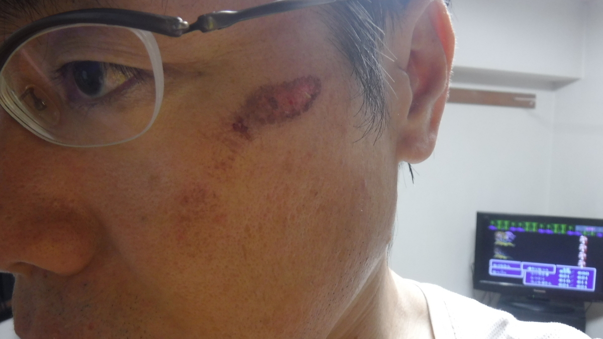 f:id:koxtupesama:20200825073431j:plain f:id:koxtupesama:20200825073431j:plain