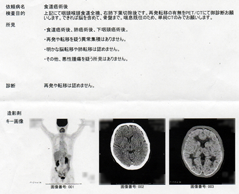 f:id:kozikokozirou:20170124123718j:plain