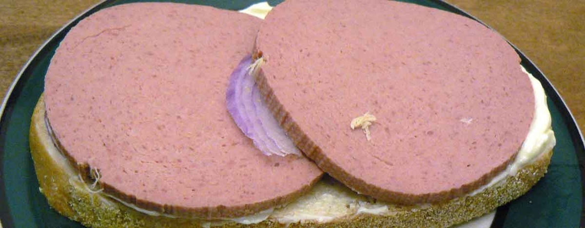 「ビタミンB2ってなに？」身体に必要と言われるビタミンを調べてみた＠ビタミンの話その5【適材適食】小園亜由美（管理栄養士・野菜ソムリエ上級プロ）糖尿病専門・甲状腺専門二田哲博クリニック勤務＠福岡姪浜・福岡天神