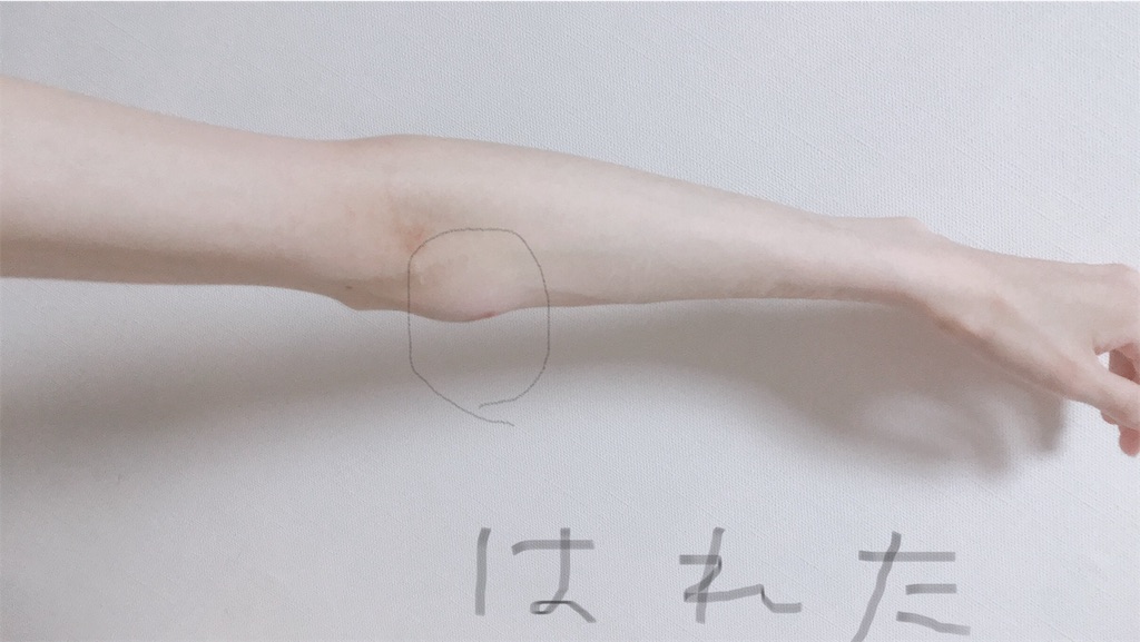 f:id:krpsarps:20190809111546j:image f:id:krpsarps:20190809111546j:image