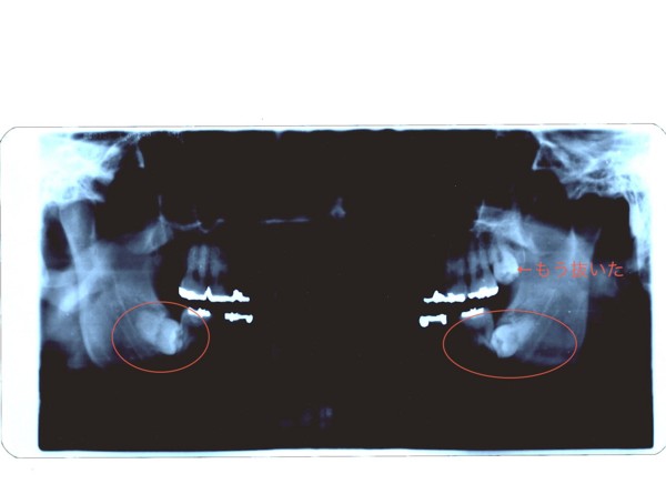 f:id:kskmeuk:20091118215127j:image