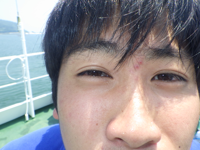 f:id:kuchinotsu:20180719151701j:plain