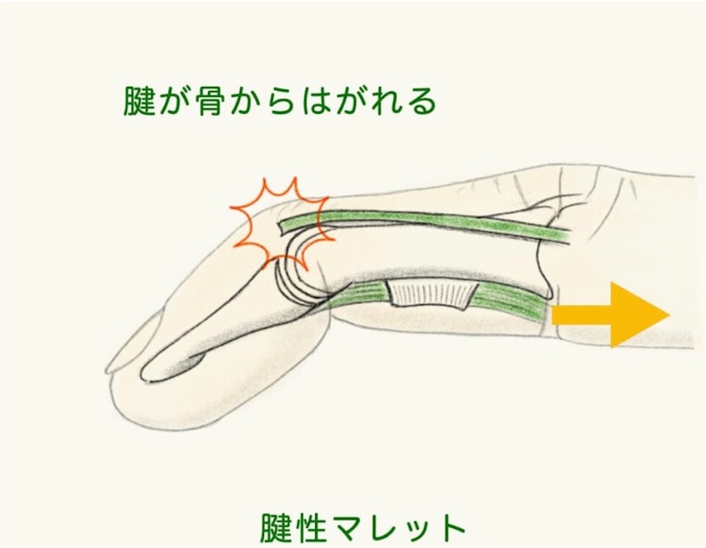 f:id:kumabou2016:20240628095011j:image