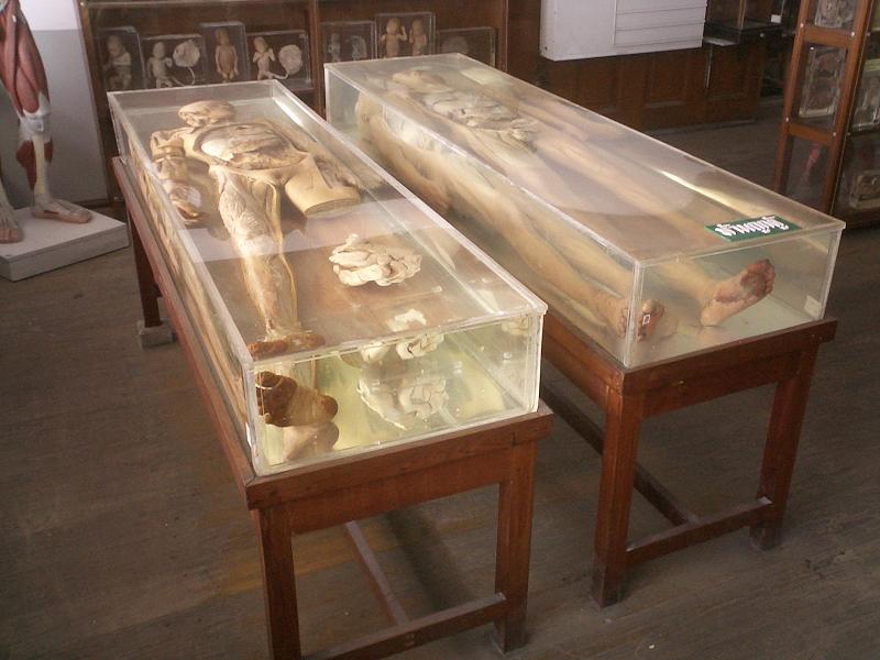 ま バンコク シリラート病院内の死体博物館と僕の腹痛 閲覧注意 Kun Maa ま ぷるんにー พร งน ま バンコク シリラート病院内の死体博物館と僕の腹痛 閲覧注意 Kun Maa ま ぷるんにー พร งน