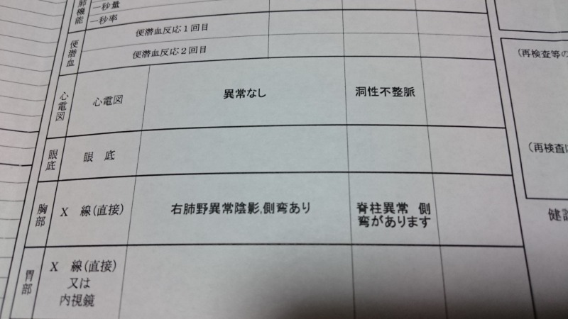 消えた不整脈と右肺の新規異常,池田町地域おこし協力隊blog