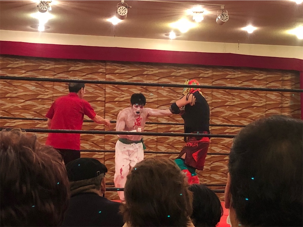 f:id:kusarigama:20180328224515j:image f:id:kusarigama:20180328224515j:image