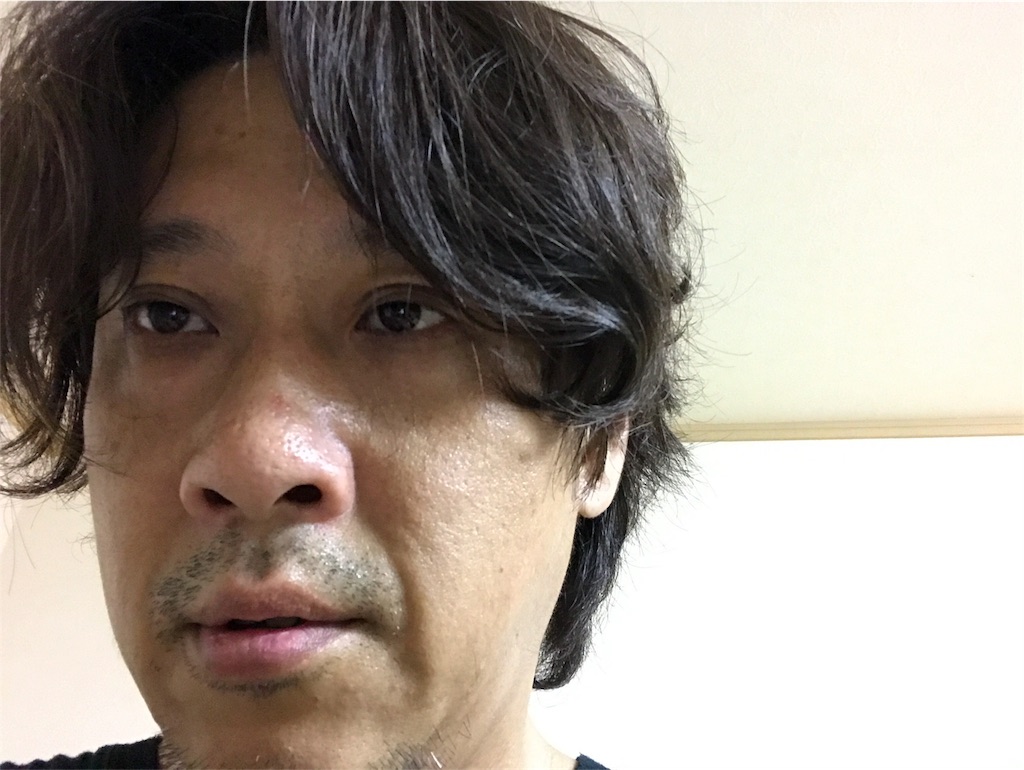 f:id:kussa:20170620213700j:plain f:id:kussa:20170620213700j:plain