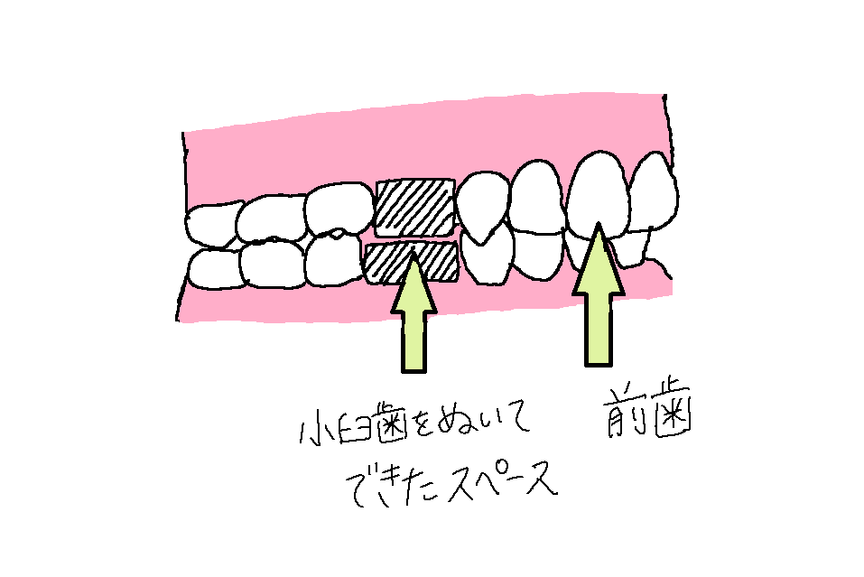f:id:kusurino-ouchi:20181226212734p:plain f:id:kusurino-ouchi:20181226212734p:plain