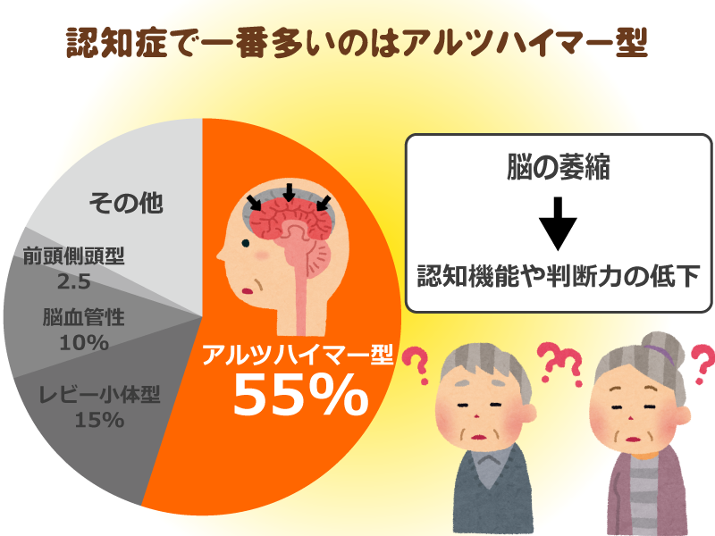 アルツハイマーとレビー小体 - くわちゃんの独り言