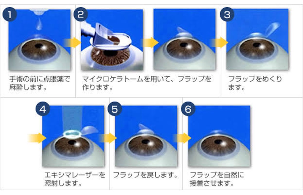 f:id:ky071811:20240203204754j:image