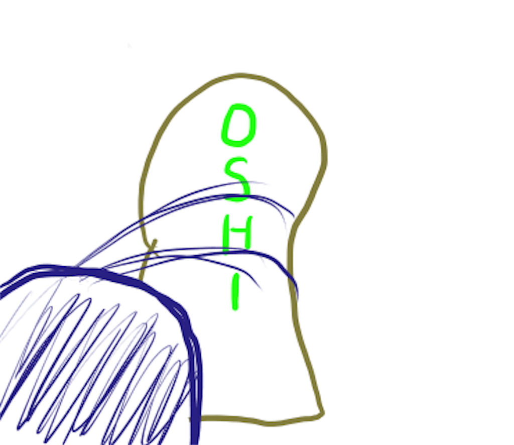f:id:kyomunokiwami:20180607005023p:image