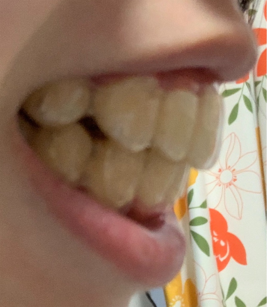 f:id:kyose22:20190219164015j:image f:id:kyose22:20190219164015j:image
