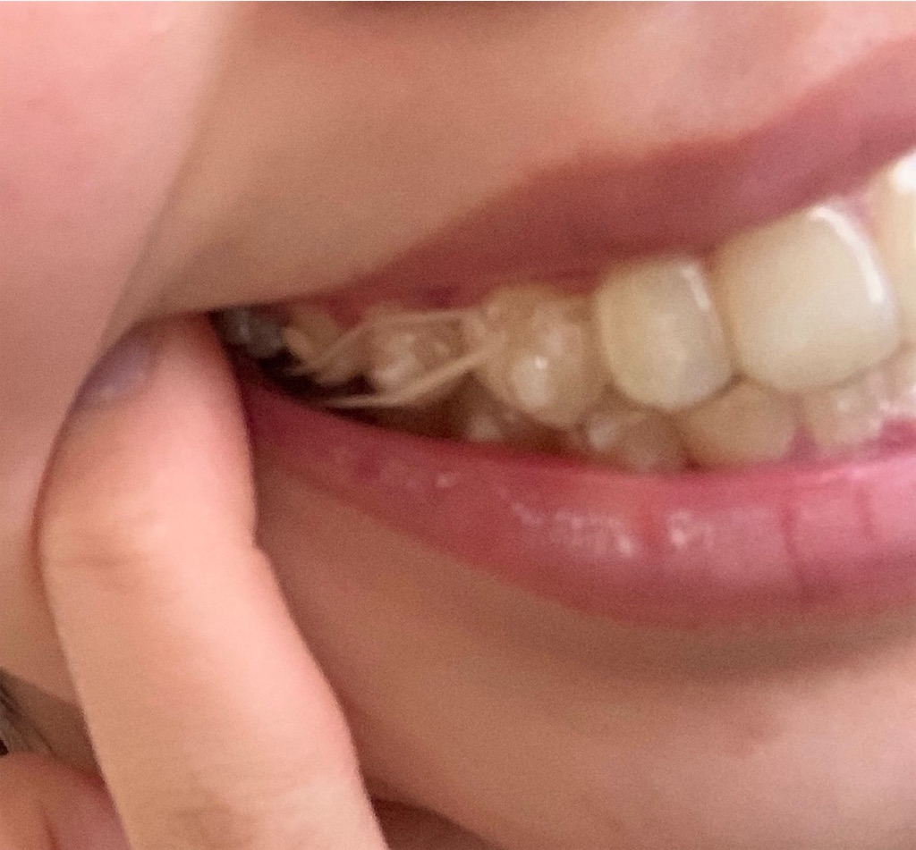 f:id:kyose22:20190409085420j:image f:id:kyose22:20190409085420j:image