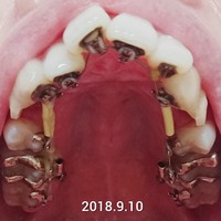 CollageMaker_20180910_194750596~01.jpg