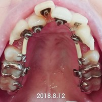CollageMaker_20180910_195847129~01.jpg