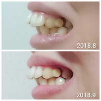 CollageMaker_20180918_232924560.jpg