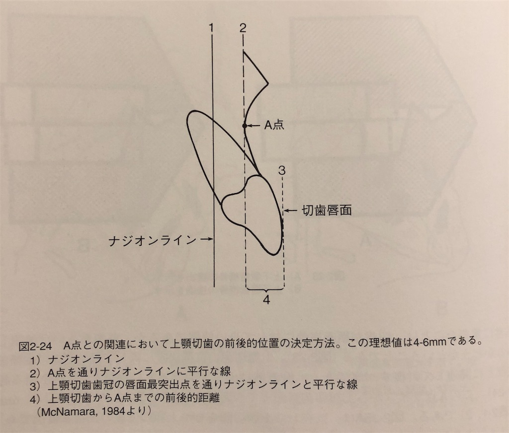 f:id:kyouseisyoshinsya:20191229220059j:image