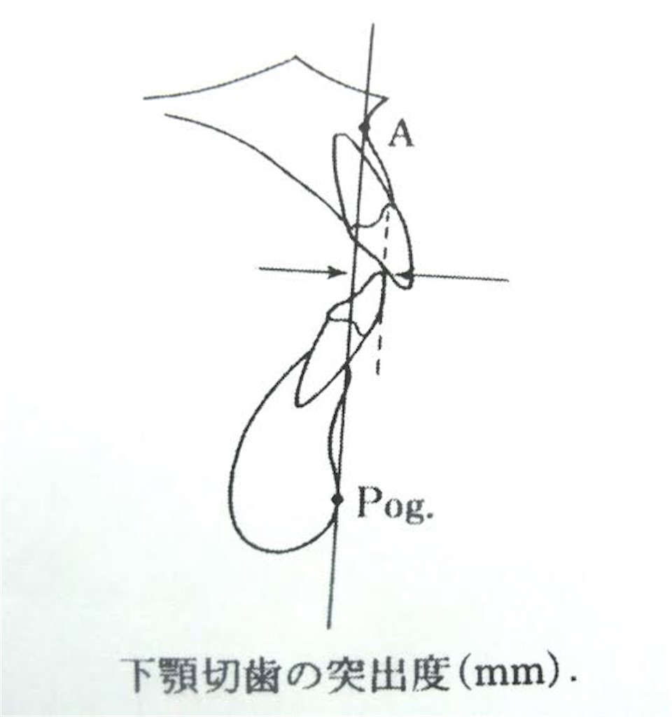 f:id:kyouseisyoshinsya:20191229233846j:image