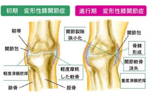 f:id:lady-jhones:20160413234510p:plain