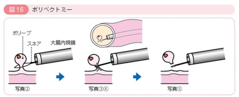 f:id:lady-jhones:20160920200227p:plain